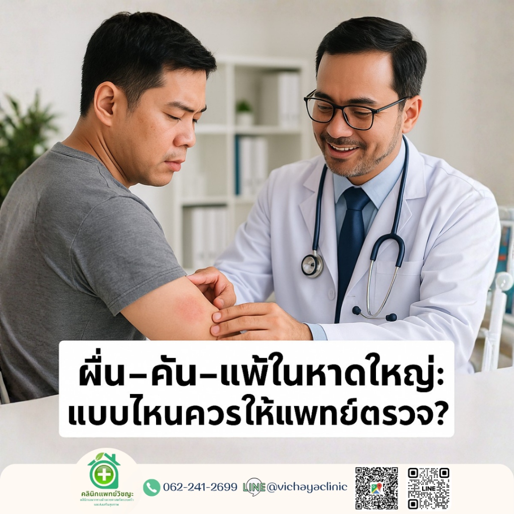 คลินิกผิวหนังหาดใหญ่ ตรวจรักษาโรคผิวหนัง ผื่นคัน ผื่นแพ้ ตุ่มคัน โดยแพทย์ คลินิกแพทย์วิชญะ หาดใหญ่ สงขลา โทร 062-241-2699